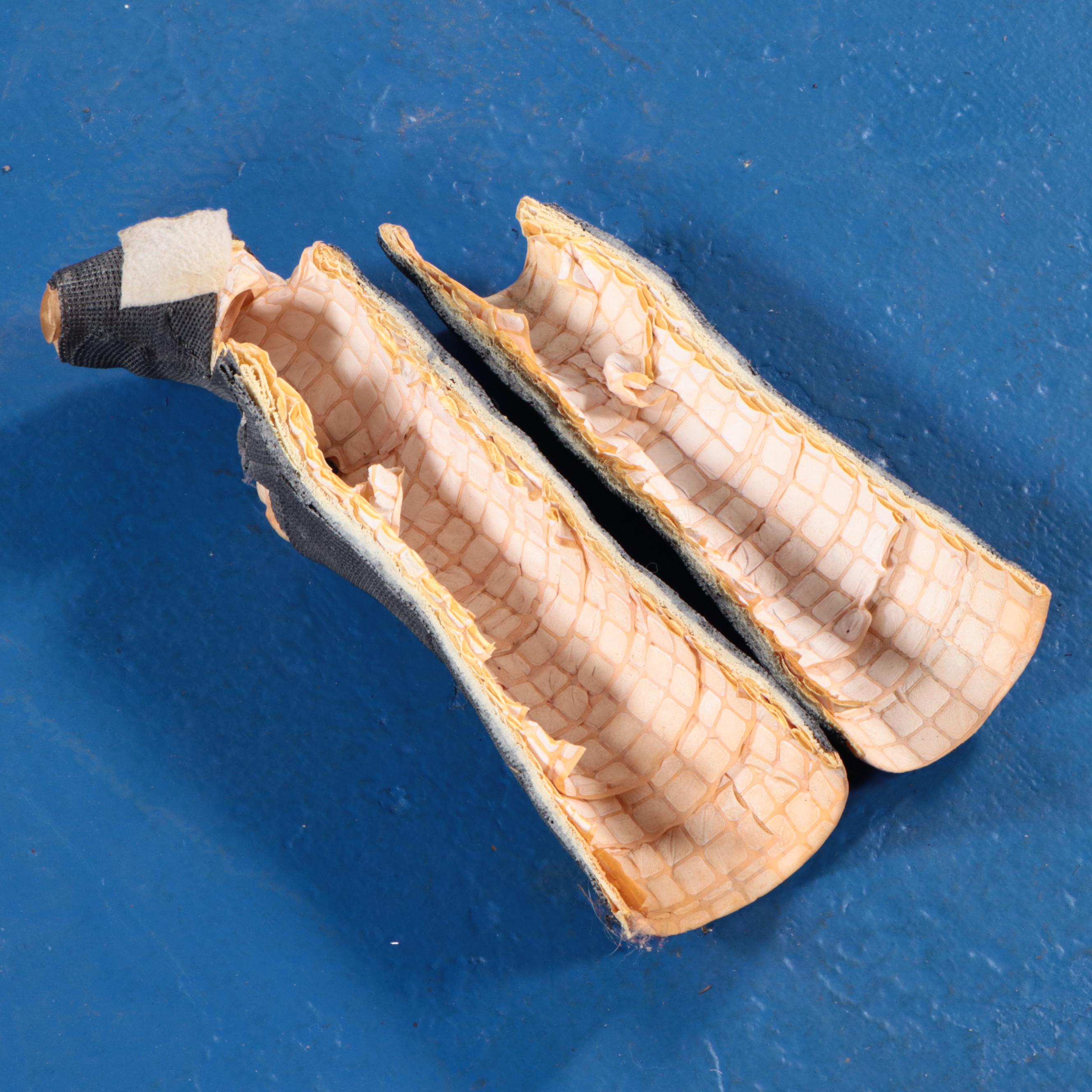 Jack White's Finger Casts