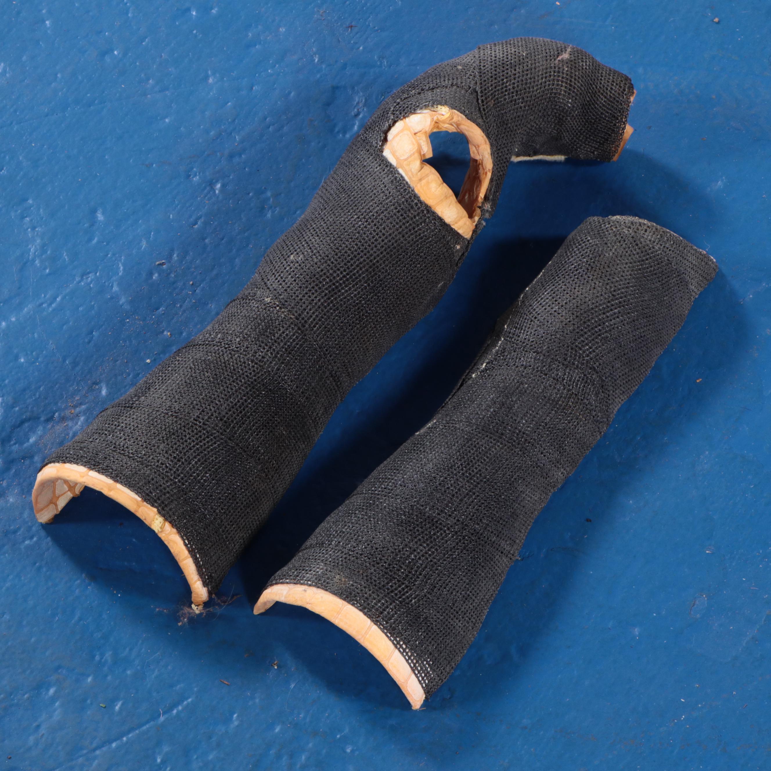 Jack White's Finger Casts