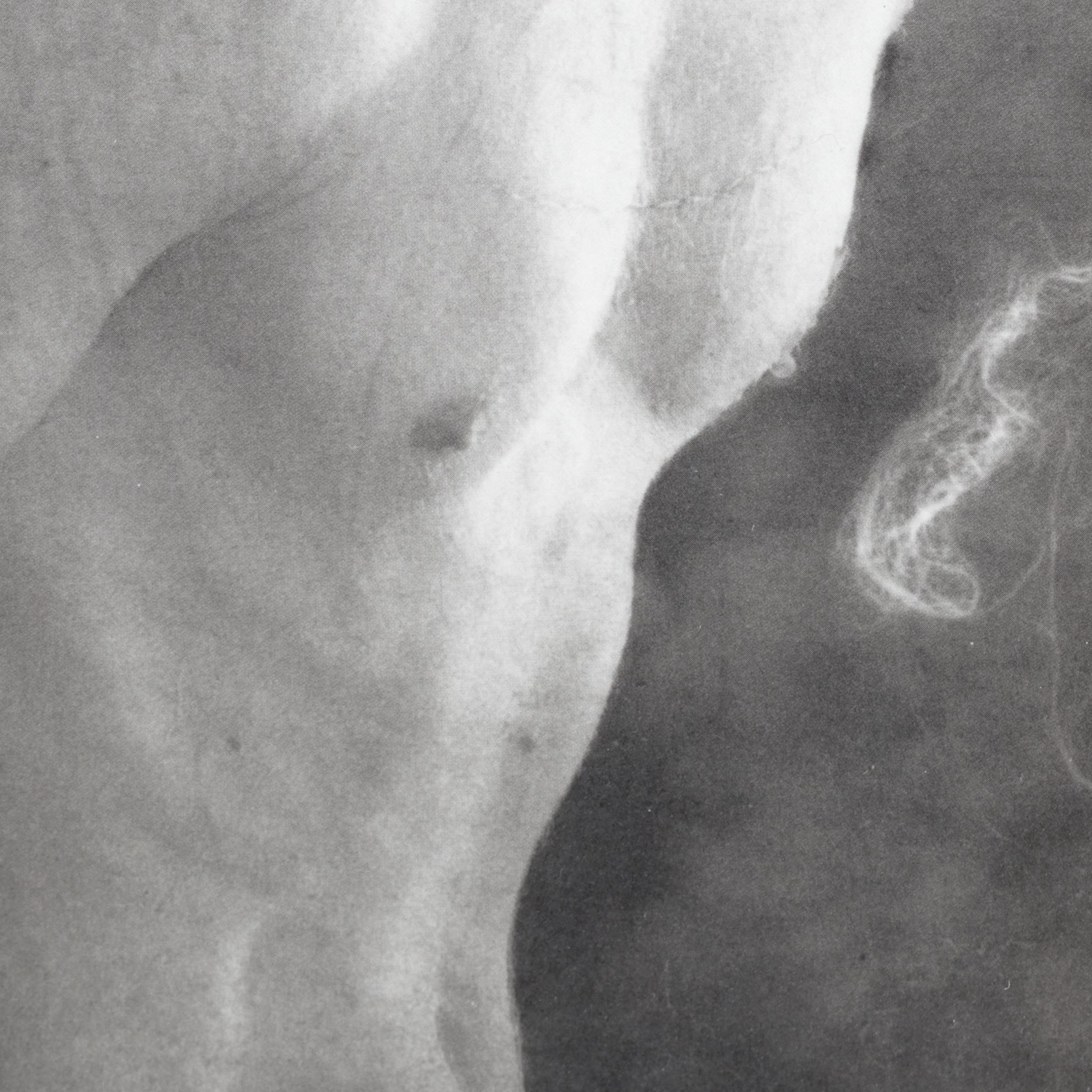 Monochrome Photolithograph "Kelly Angel" by Kelly Grider