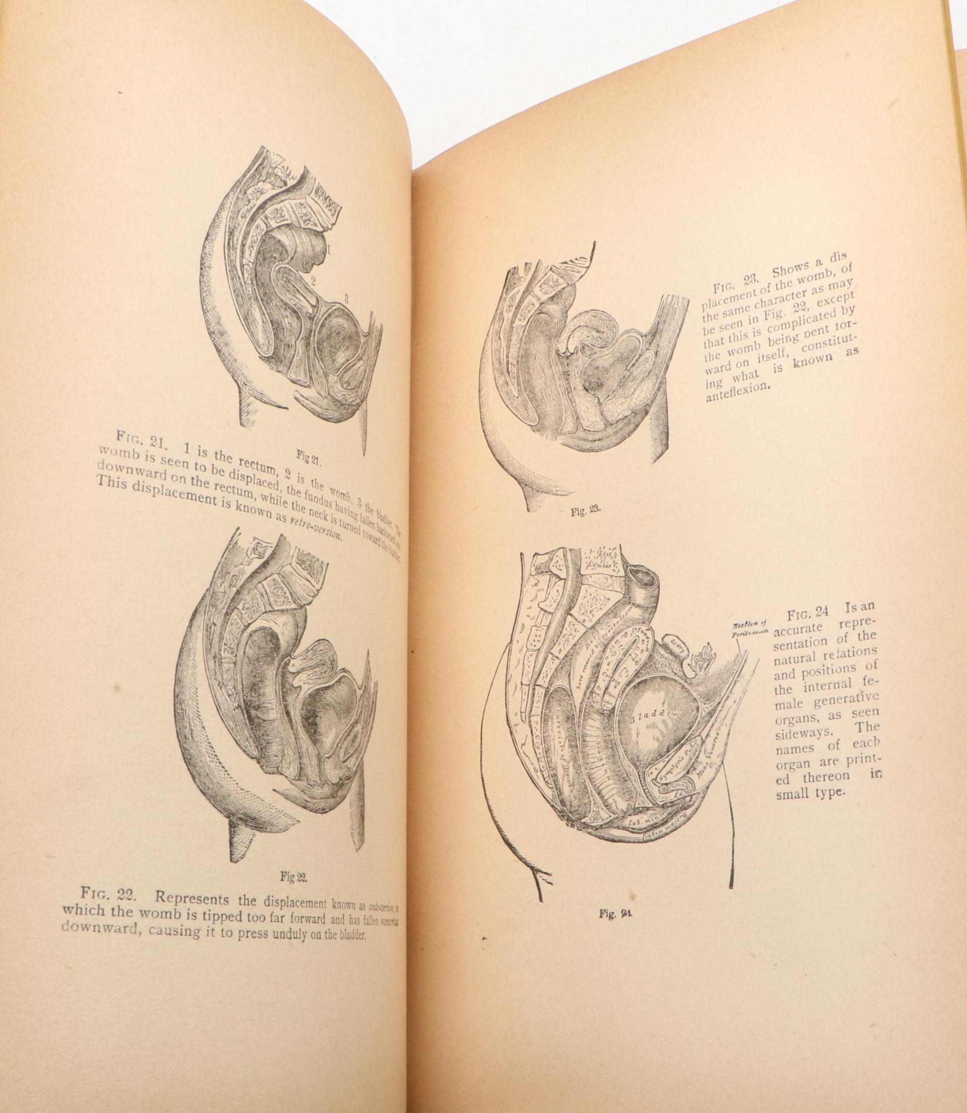 Illustrated "Practical Home Doctor for Women and Children" by David Wark, 1882