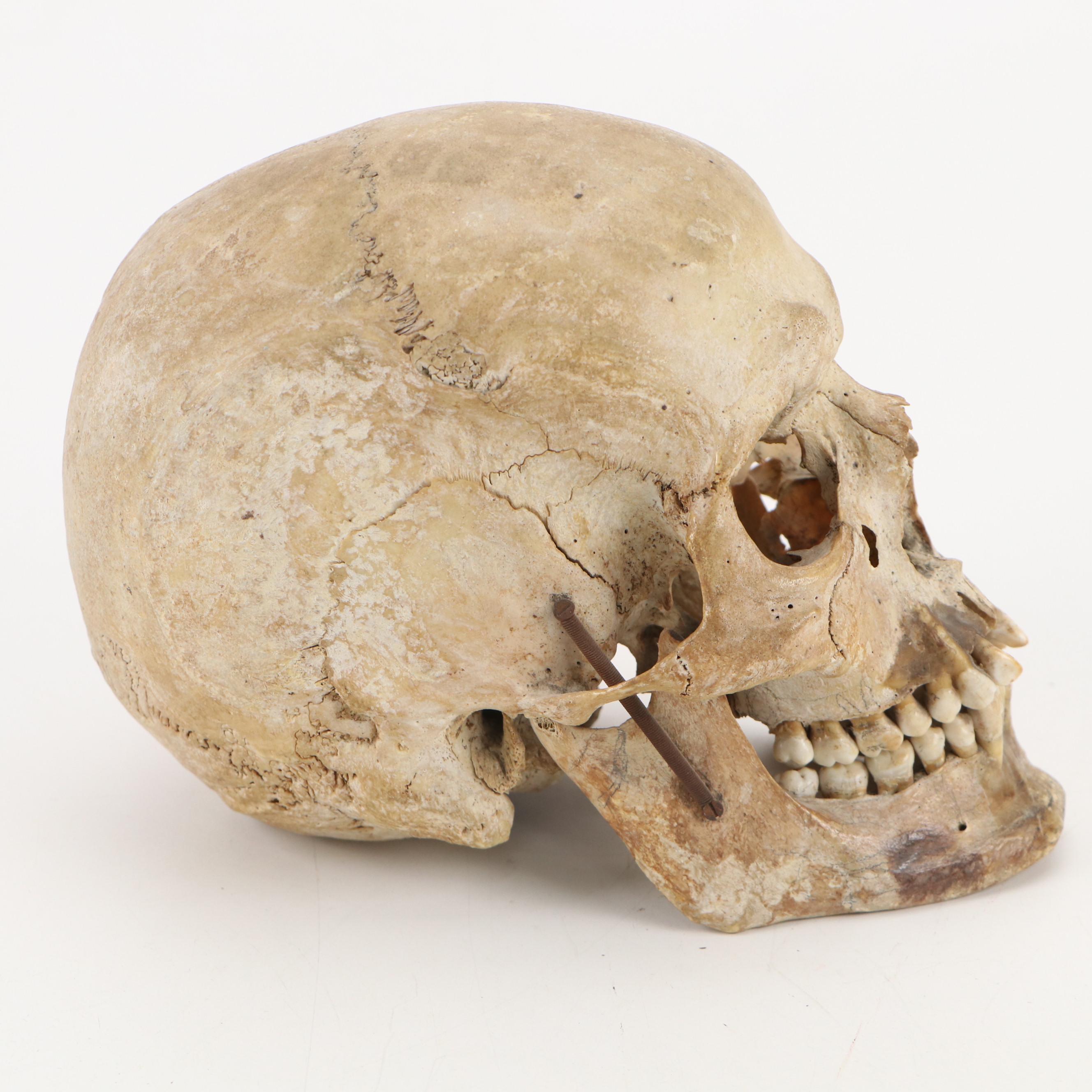 Human Skull Medical Specimen