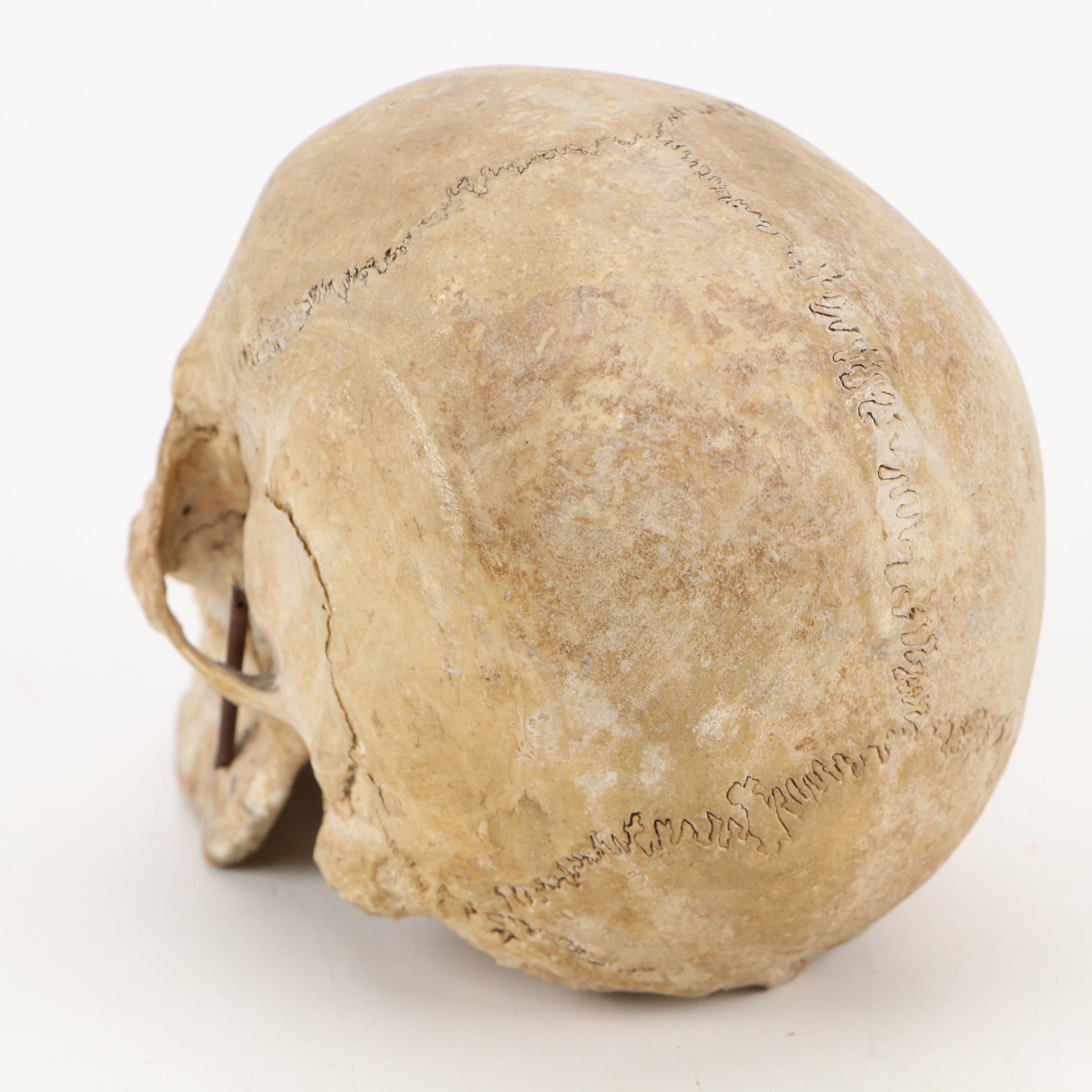 Human Skull Medical Specimen