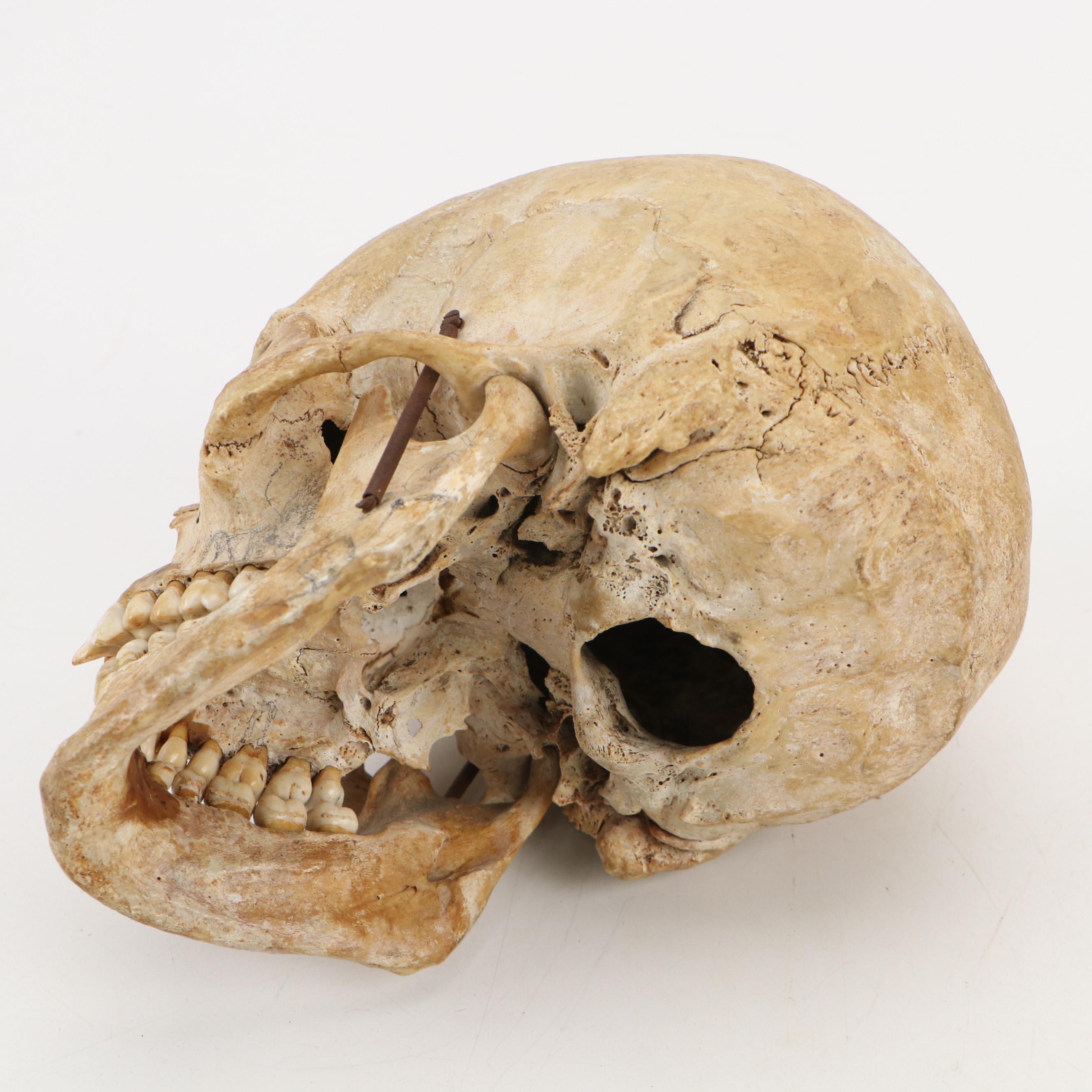 Human Skull Medical Specimen