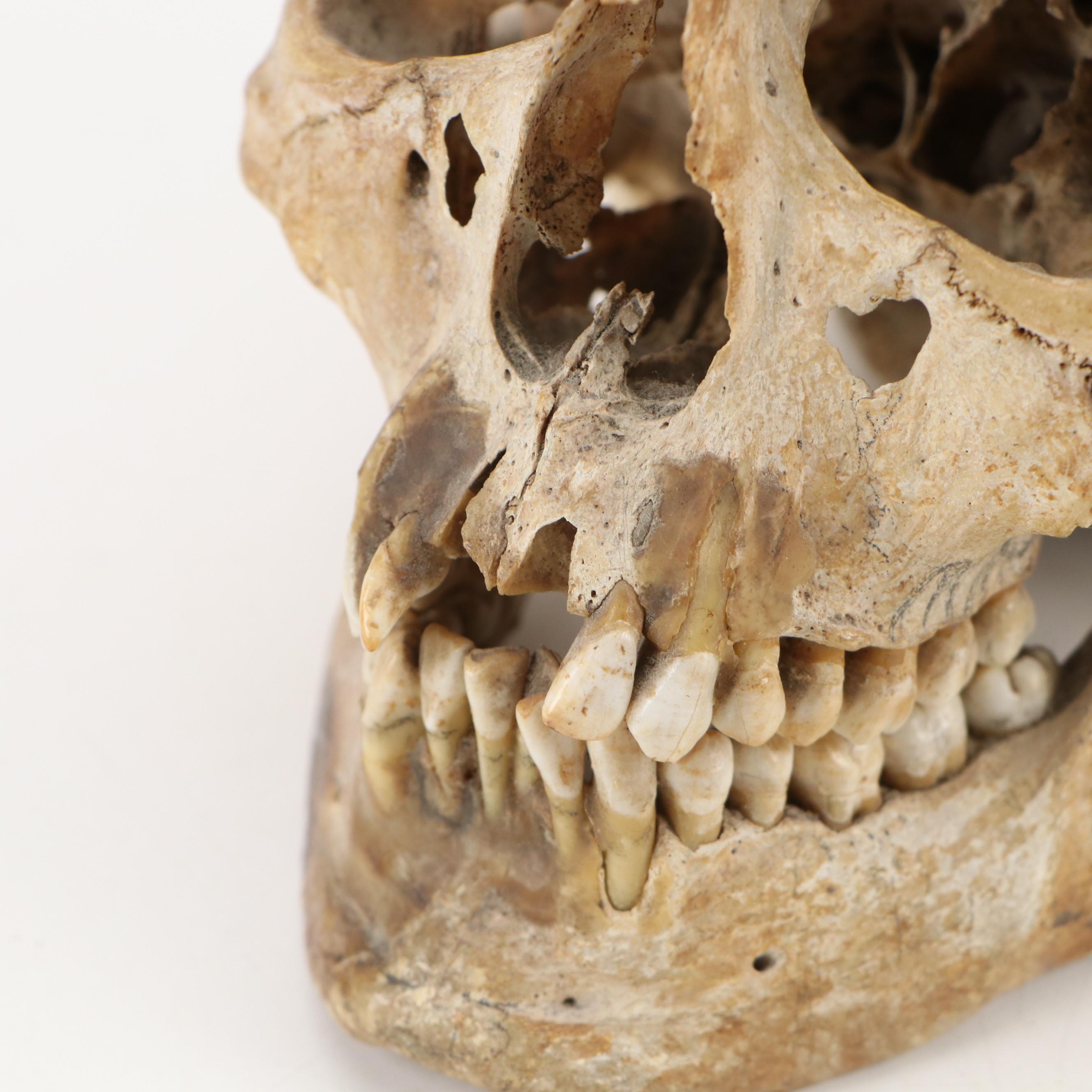 Human Skull Medical Specimen