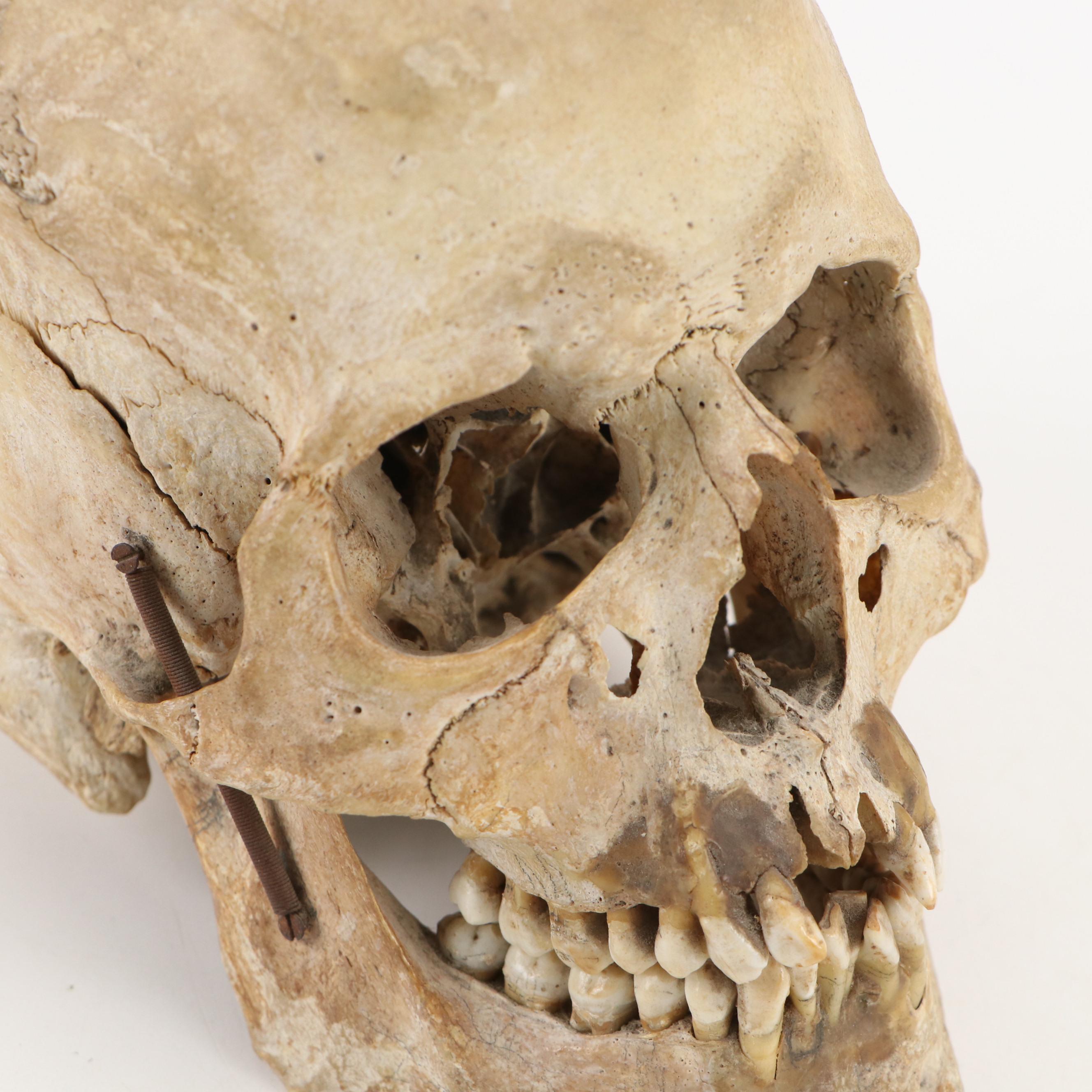 Human Skull Medical Specimen