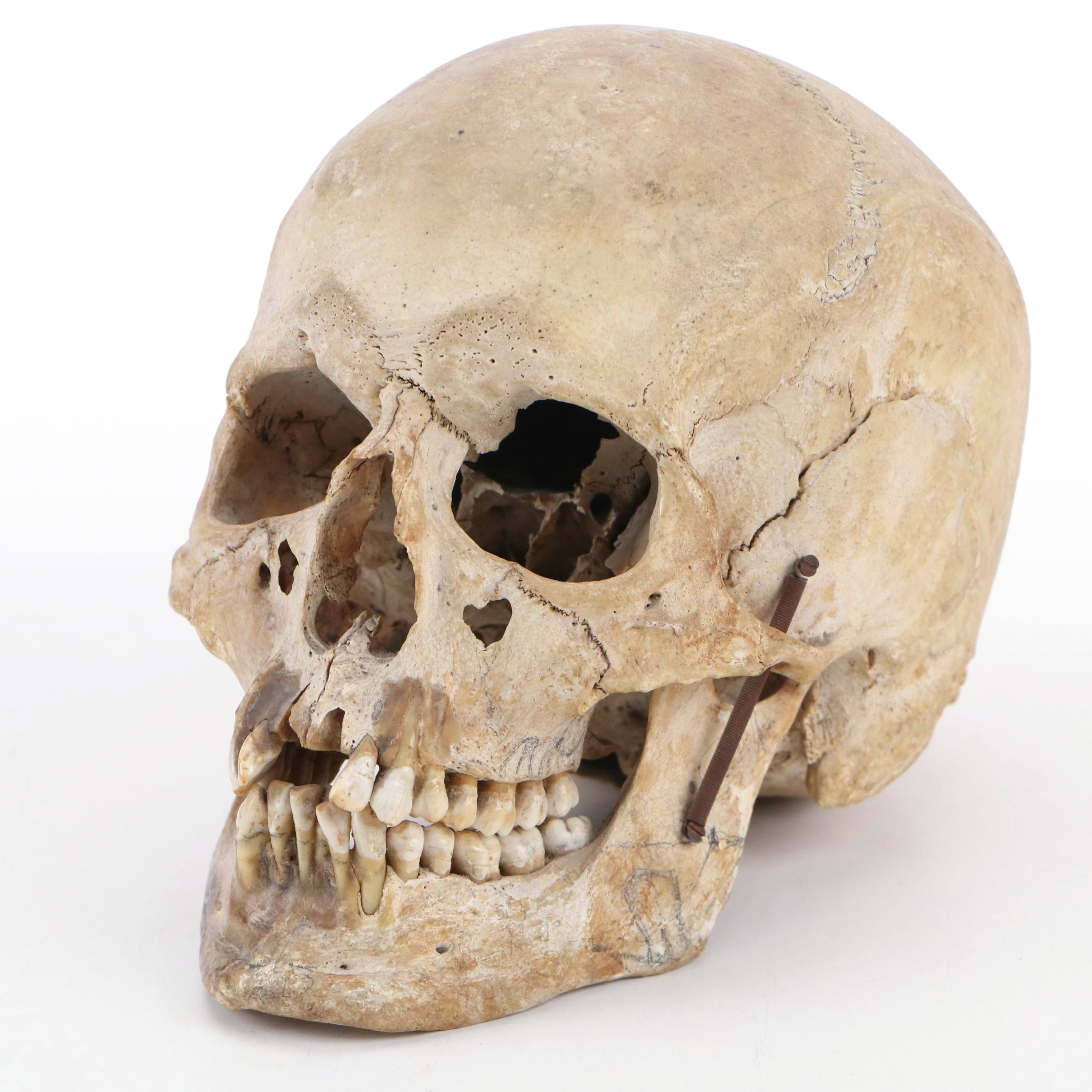 Human Skull Medical Specimen