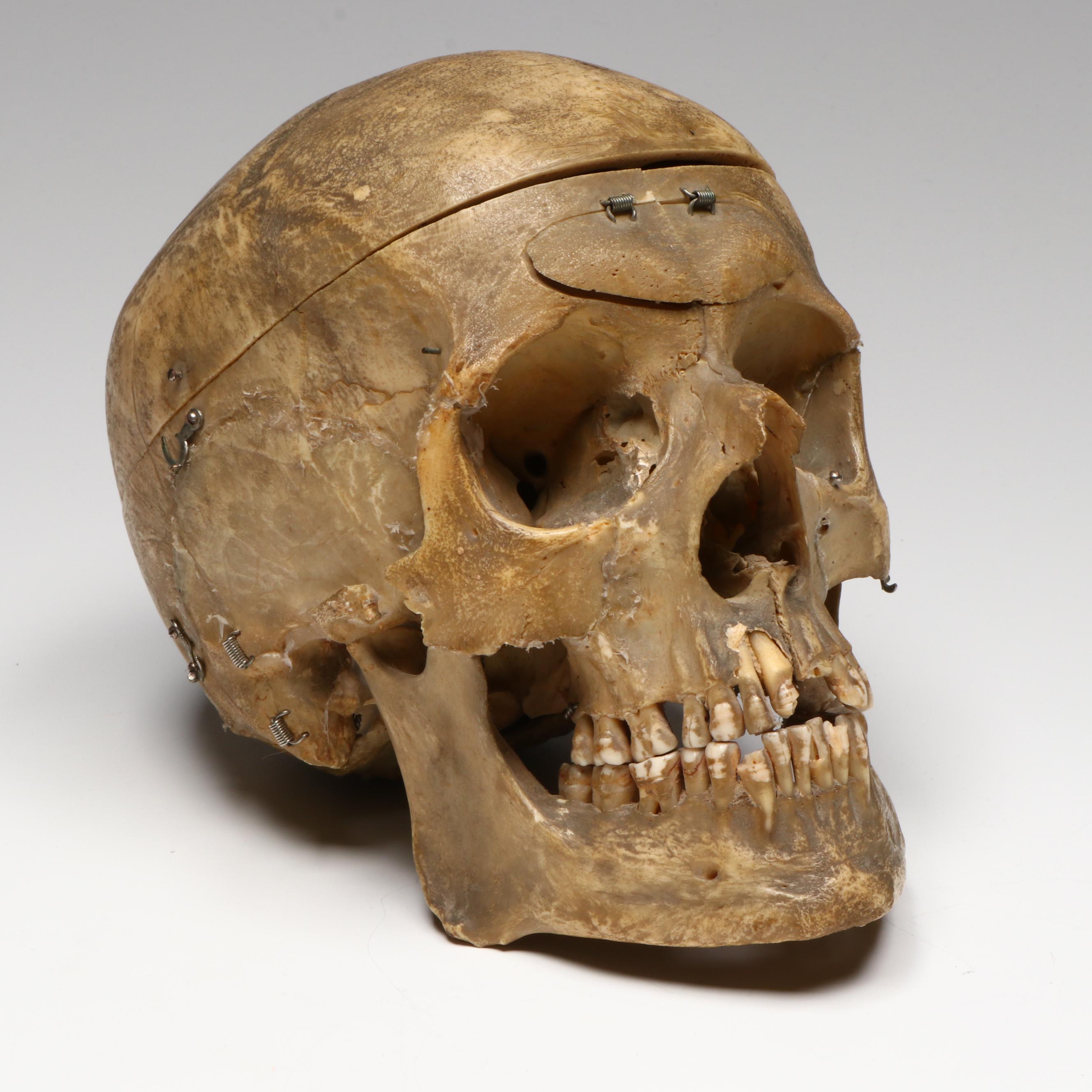 Human Skull Medical Specimen with Leather Doctor's Bag, 20th Century