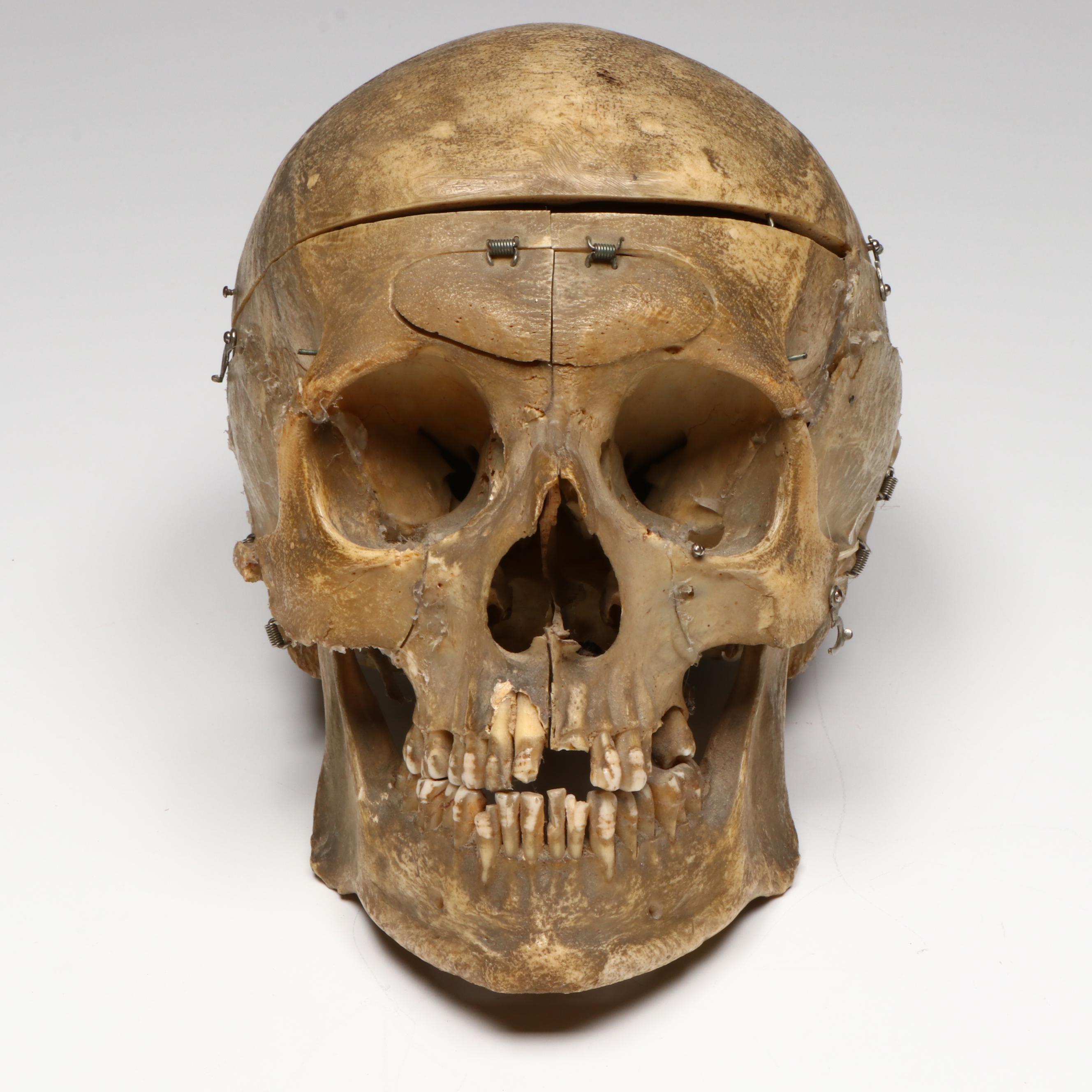 Human Skull Medical Specimen with Leather Doctor's Bag, 20th Century