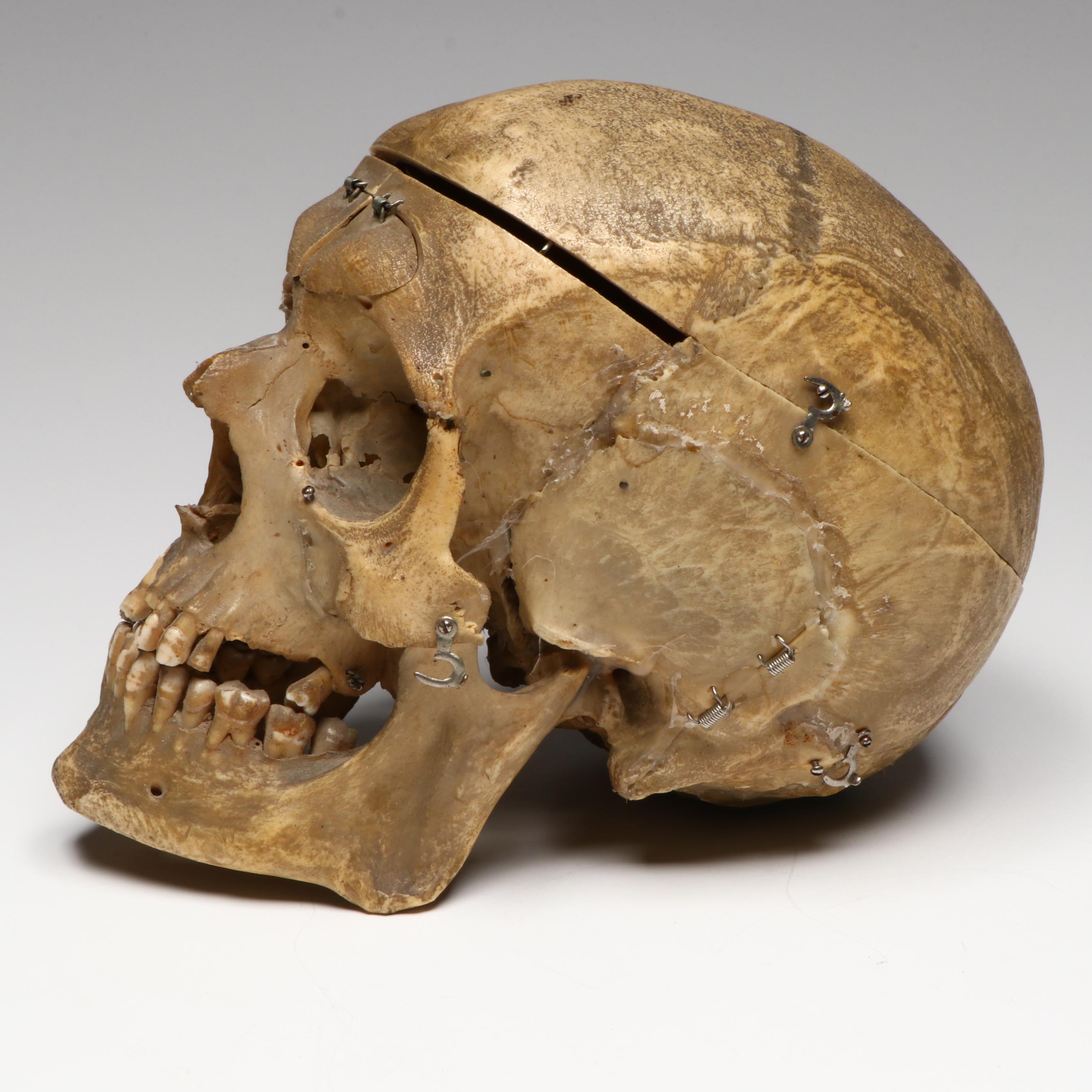 Human Skull Medical Specimen with Leather Doctor's Bag, 20th Century