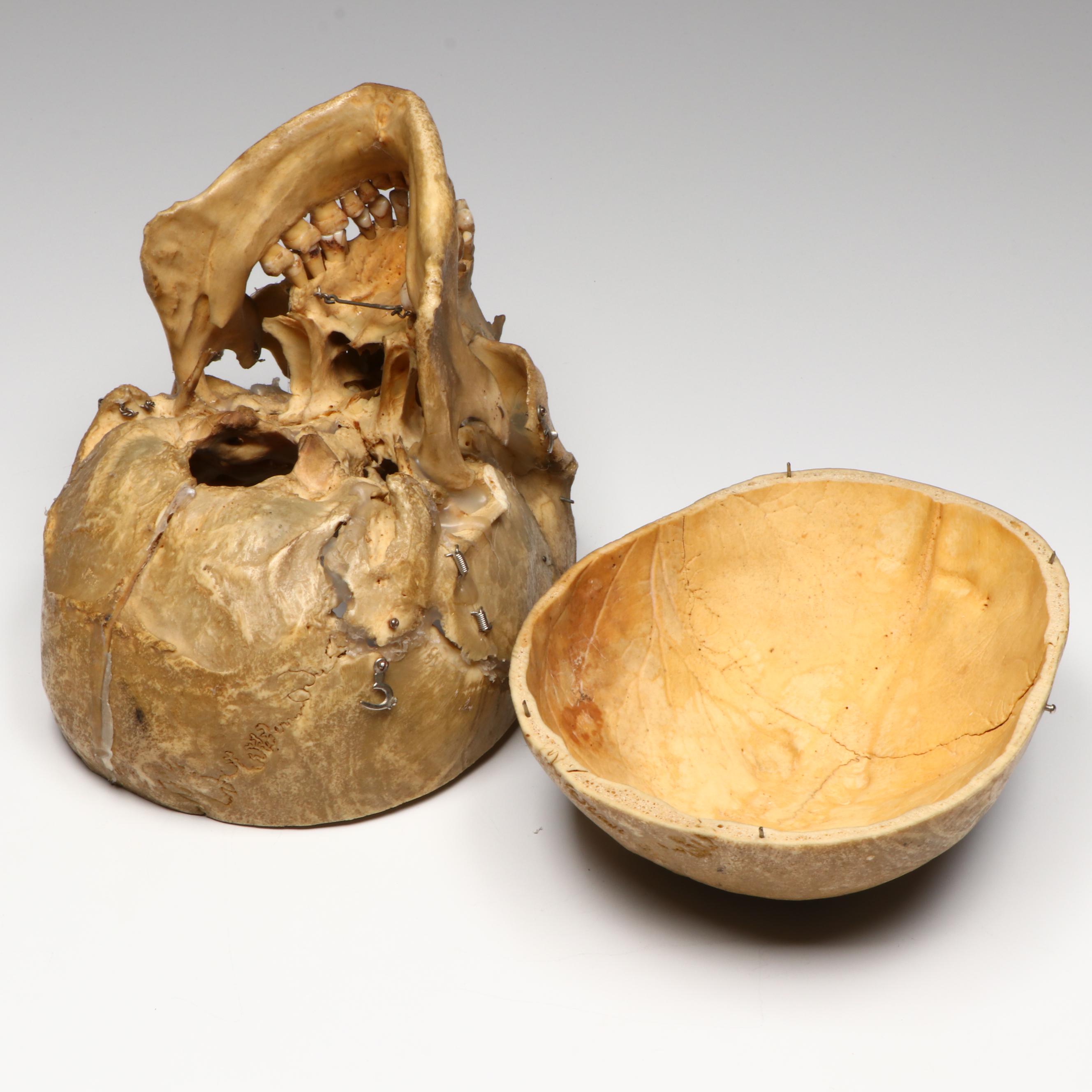 Human Skull Medical Specimen with Leather Doctor's Bag, 20th Century