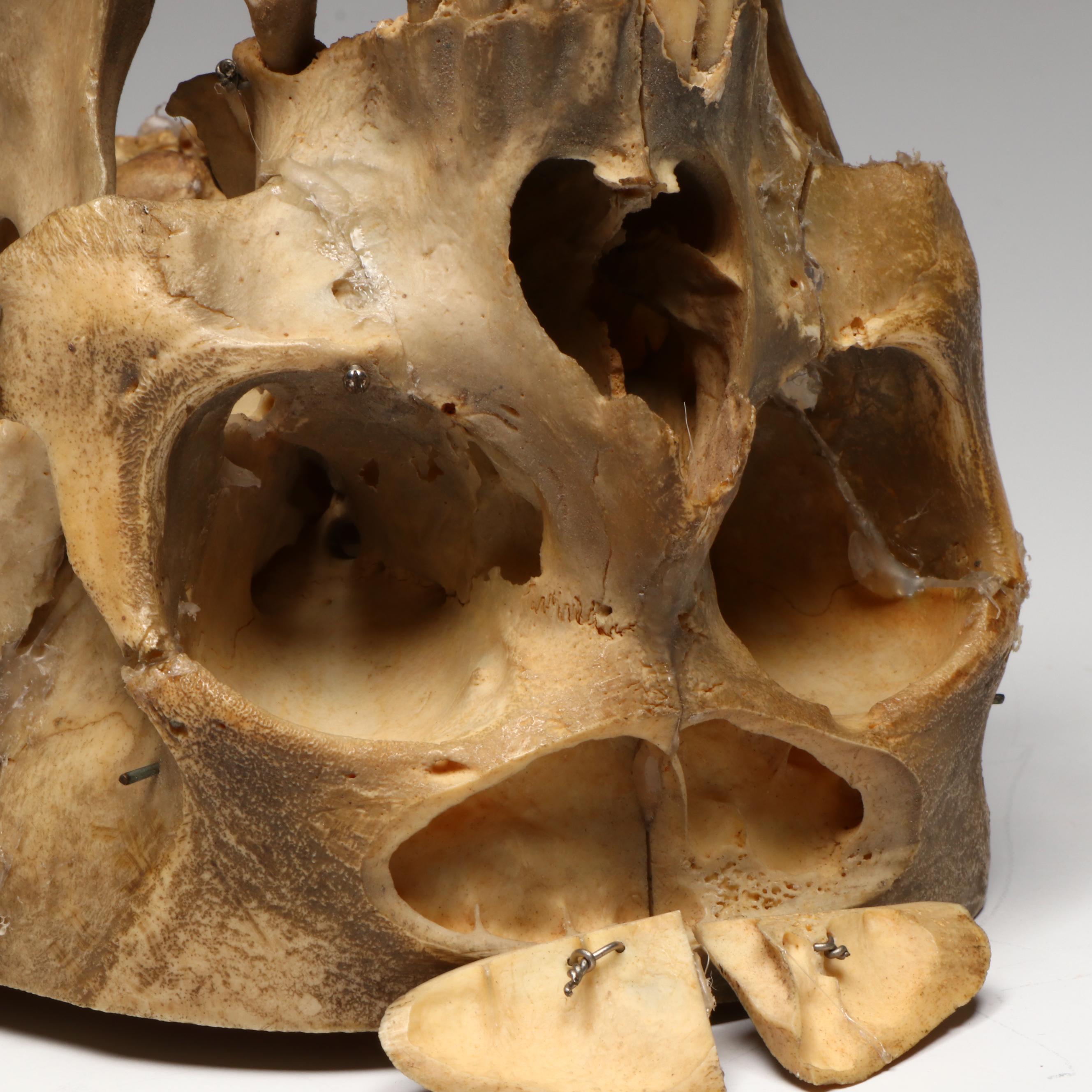 Human Skull Medical Specimen with Leather Doctor's Bag, 20th Century