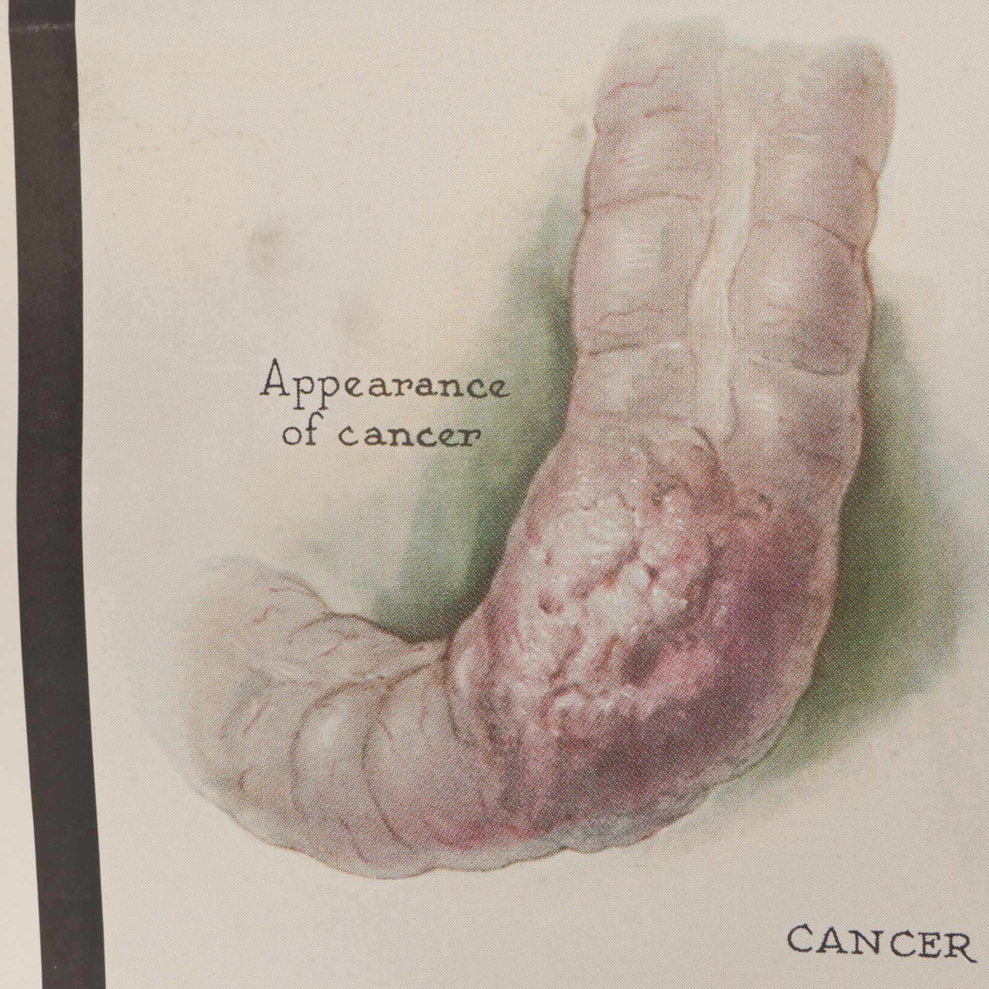 Petrolagar Laboratories Illustrated Medical Posters