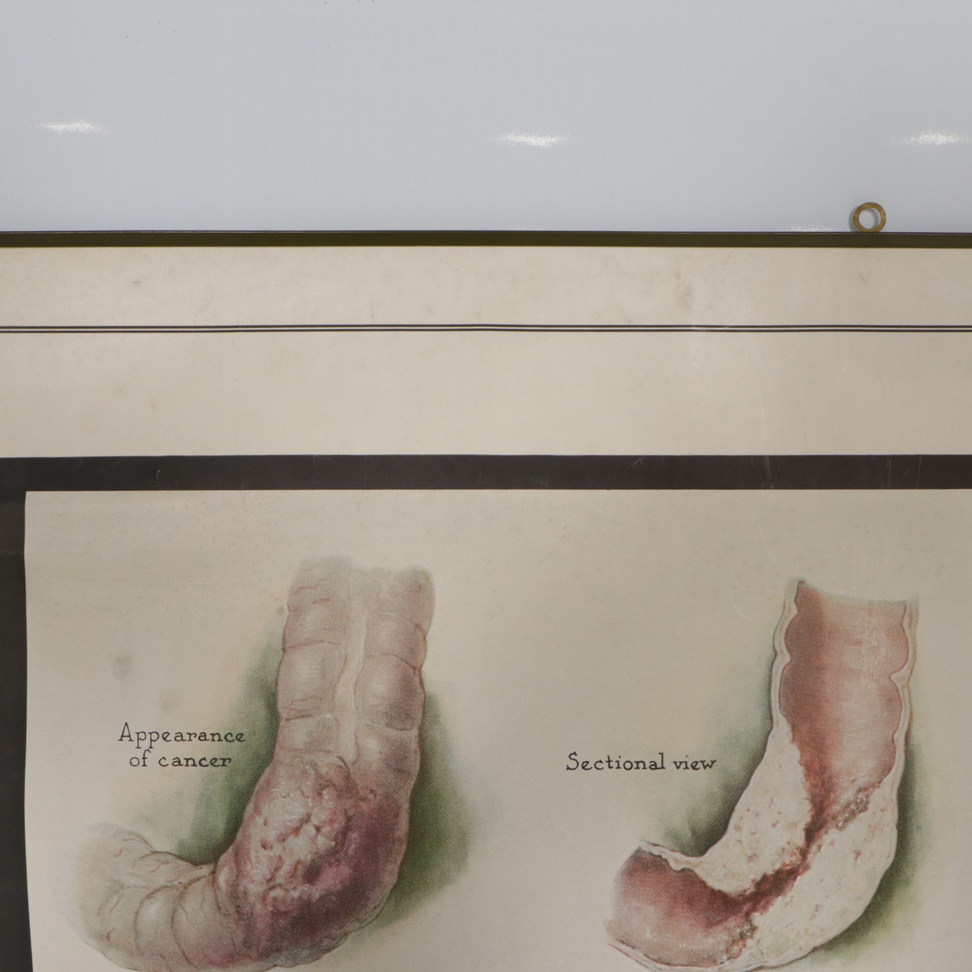 Petrolagar Laboratories Illustrated Medical Posters