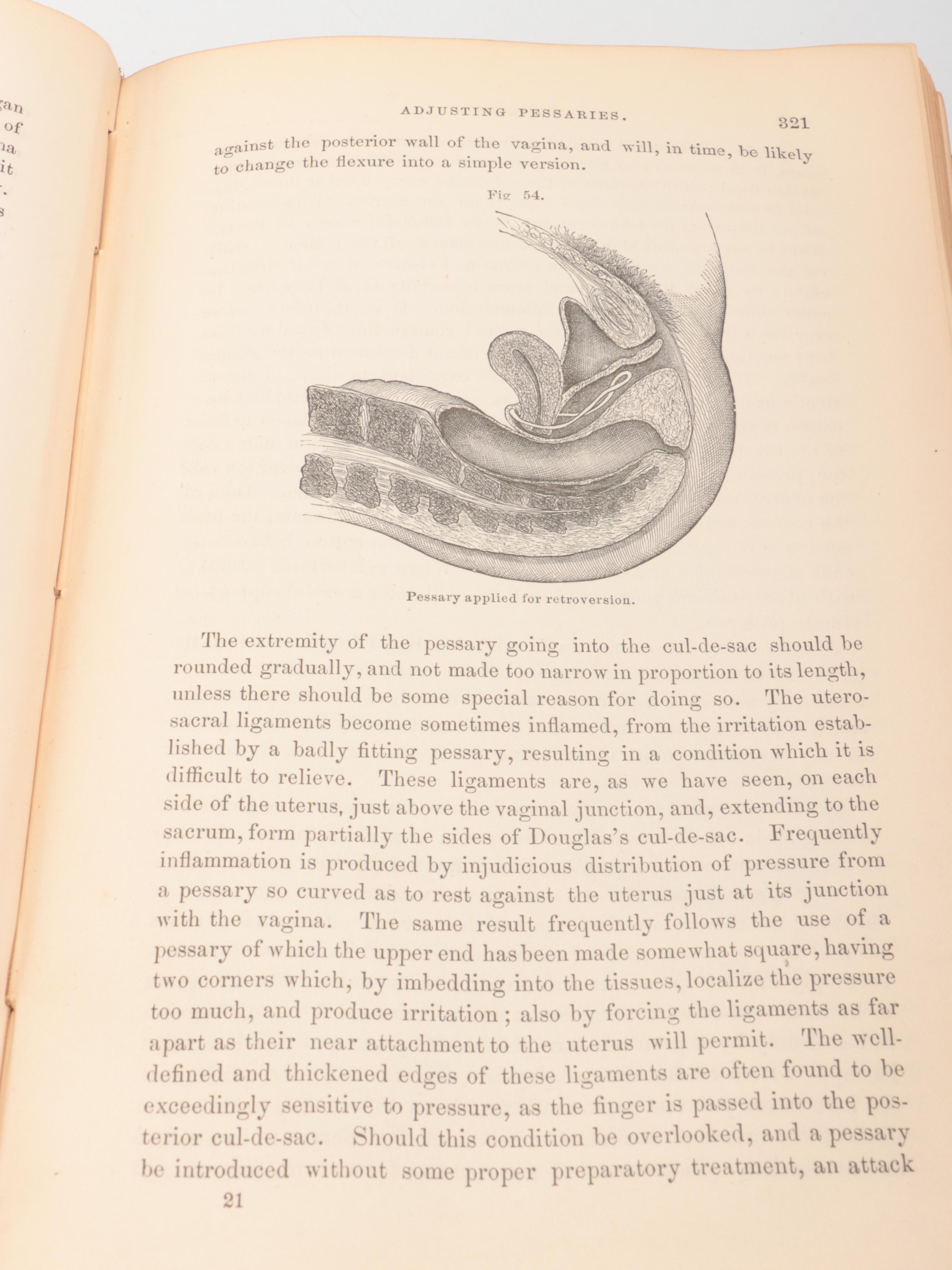 "The Principles and Practice of Gynæcology" by Thomas Addis Emmet, 1879