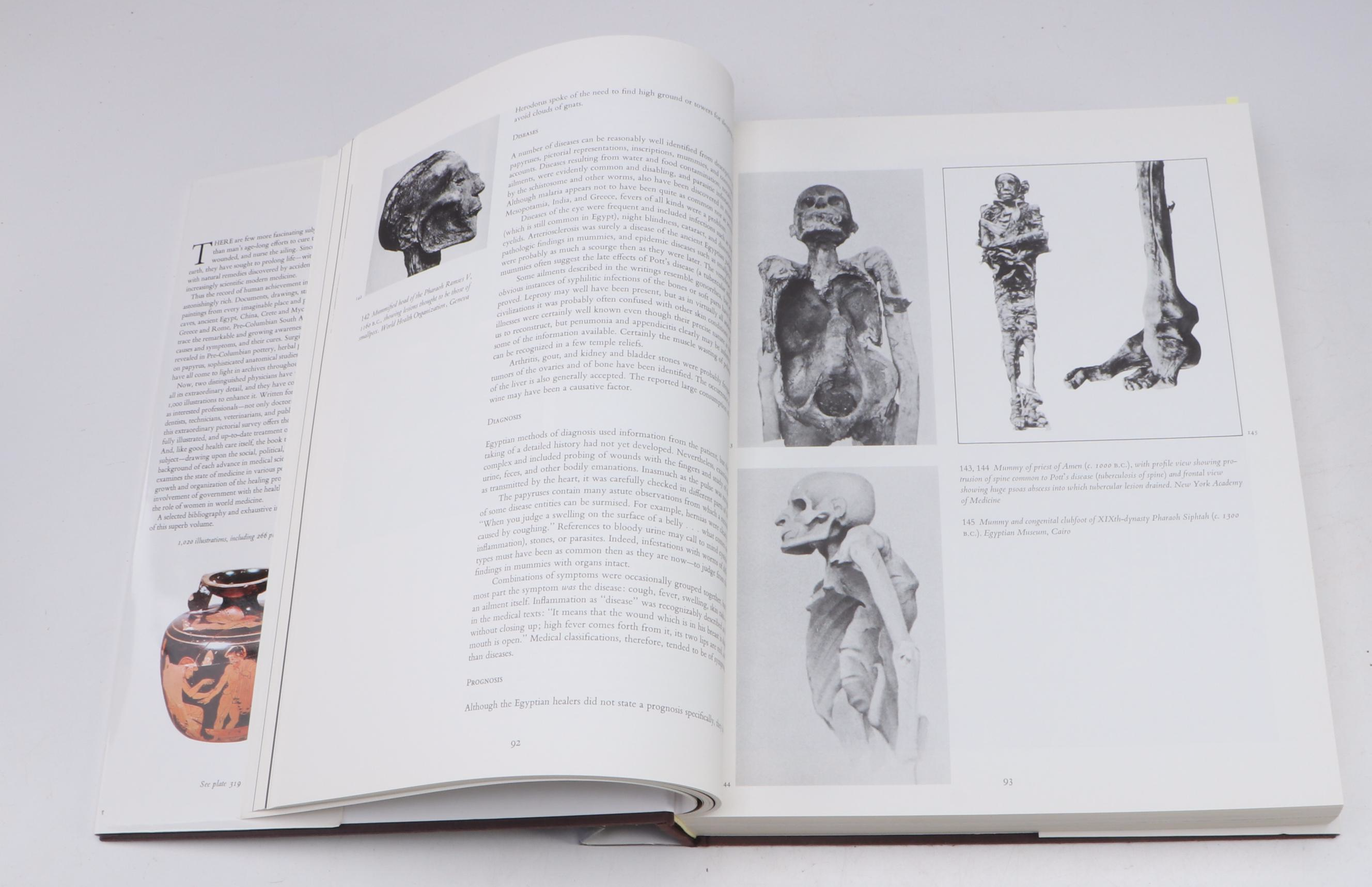 "Medicine: An Illustrated History" by Albert Lyons and R. J. Petrucelli II, 1987