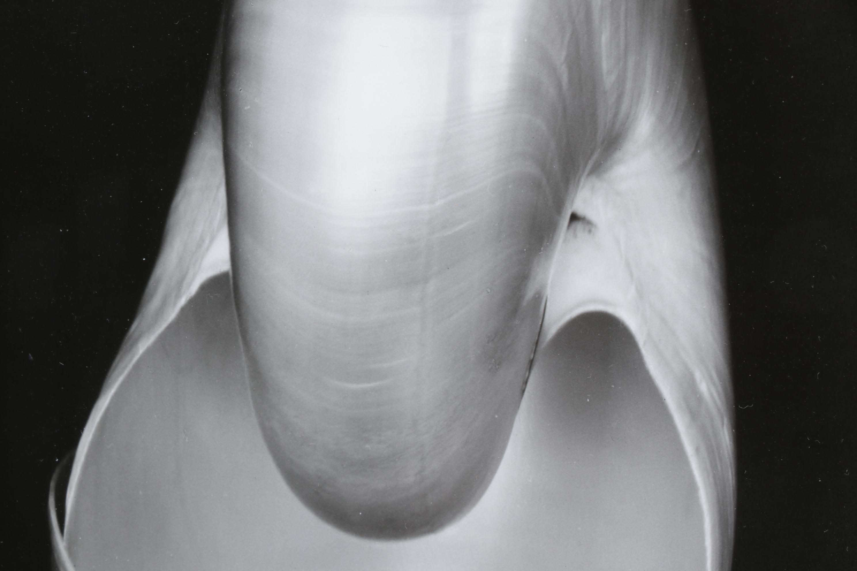 Edward Weston Silver Gelatin Photograph "Two Shells", 1927